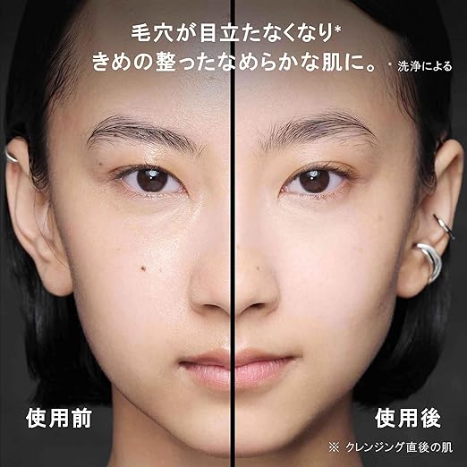 Shu Uemura Black Cleansing Oil – Pore-Refining Makeup Remover & Serum 150mL [Alcohol-free]