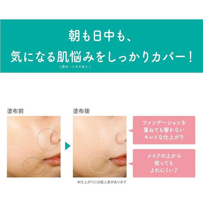 SANA Suhada Kinenbi Medicated Skin Care Concealer AC White – 15g [Alcohol-free]